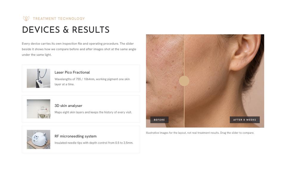 Aesthetic Clinic template — Devices and results section