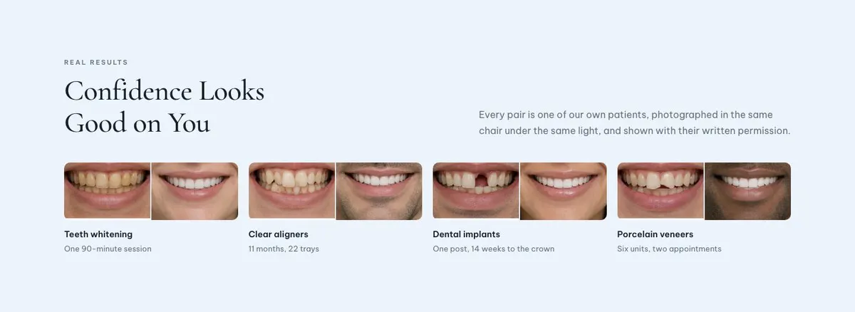 Aesthetic Clinic template — Results section